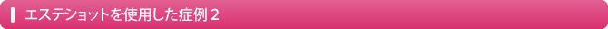 エステショットを使用した症例２
