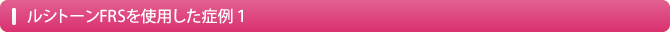 ルシトーンを使用した症例１