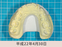 クリアープラスチックアプライアンスシステム１平成22年4月30日