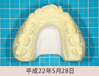 クリアープラスチックアプライアンスシステム１平成22年5月28日
