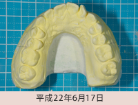 クリアープラスチックアプライアンスシステム１平成22年6月17日