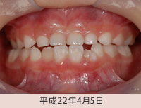 拡大床１平成22年4月5日