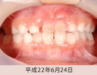拡大床１平成22年6月24日
