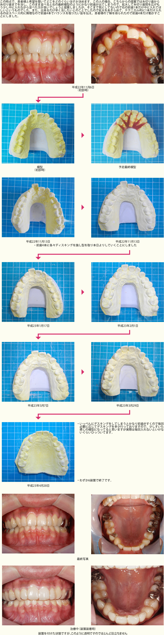 クリア・オーソドンティック・アプライアンスシステムのみでした症例