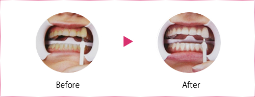 オフィスブリーチング